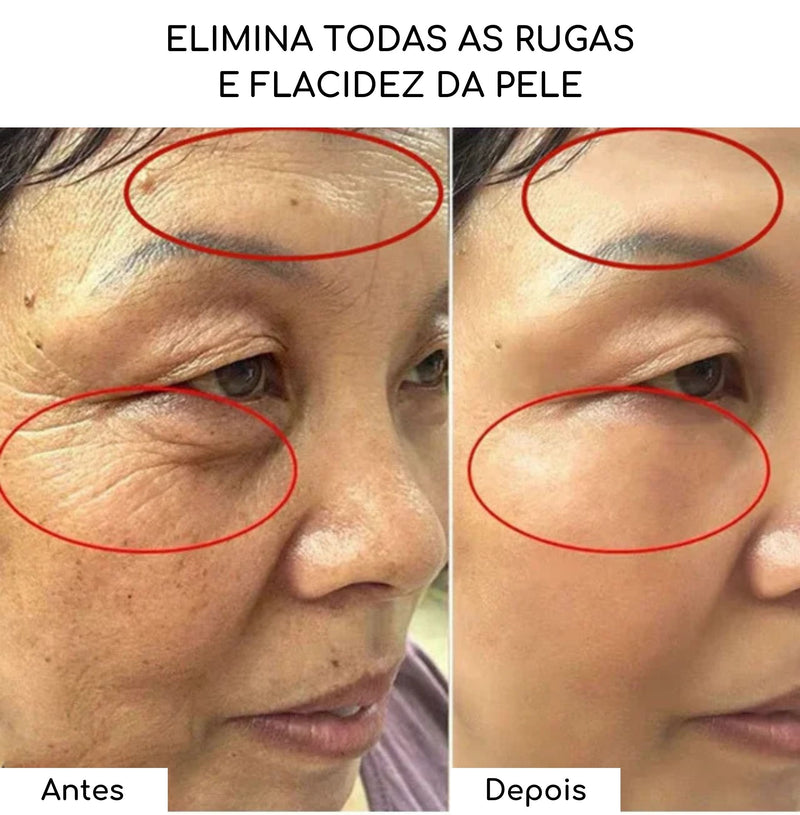 Linha de colágeno & Golden Serum